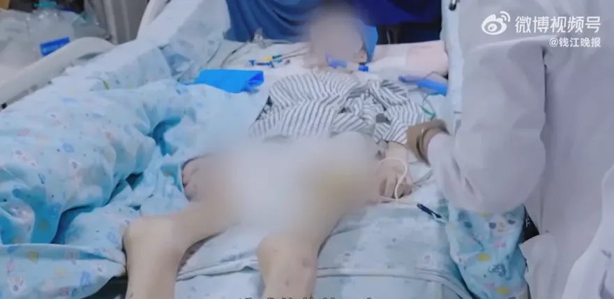 影/15歲少女「為愛減肥」多重器官衰竭亡　50天不吃喝體重剩24.8公斤