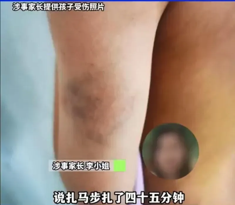 影/體罰小學生「蹲馬步1小時+棍打」　女教師被解僱獲44家長連署挽留