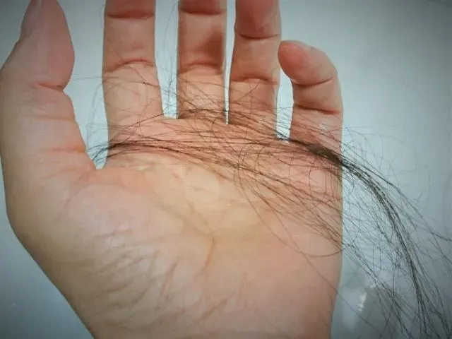 落髮好困擾！洗頭都掉一堆頭髮　營養師：強健髮質可從5類營養素下手