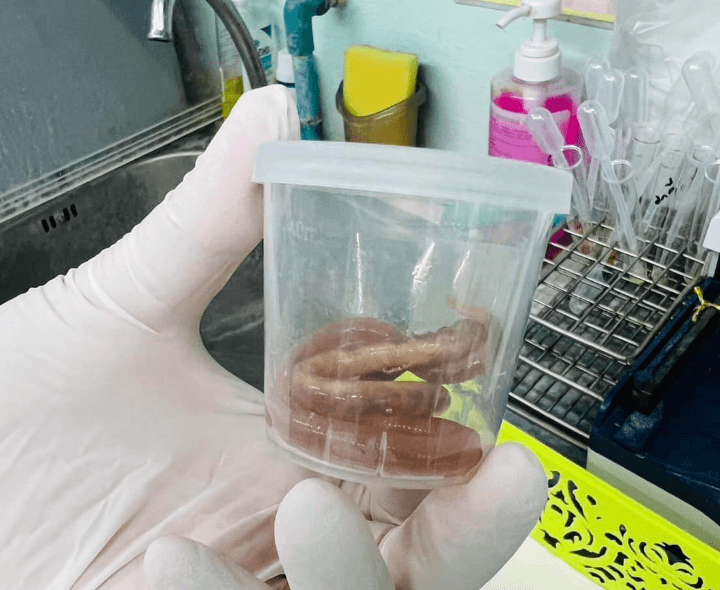 只因「愛吃生菜」！泰國孕婦頻腹痛　醫生從嘔吐物中找出2條「超長蛔蟲」
