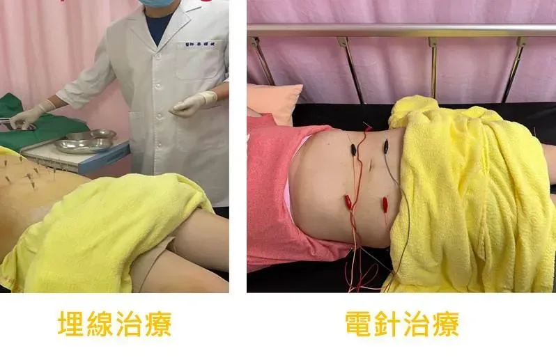 36歲媽媽生完孩子暴肥至71Kg！靠中醫「這兩招 」成功減下15公斤