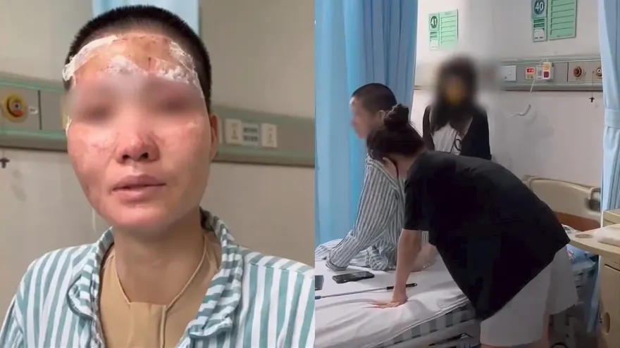 影/夫家以意外燒傷募得千萬善款　毀容妻怒控「詐捐」：丈夫潑汽油抱我輕生