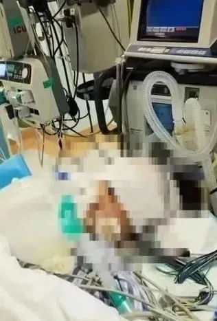 離譜！正妹花13萬隆鼻竟「用錯麻醉劑量」喪命　診所火速改名繼續營業
