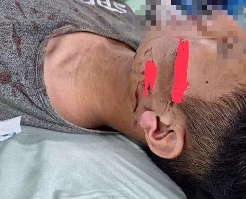 彰化警誤逮少年害縫17針！　「Lin bay好油」2度聲援：真的覺得很扯