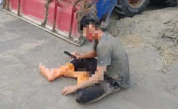 被當壞人還縫17針！彰化少年毀容也不恨　立志從警不改變