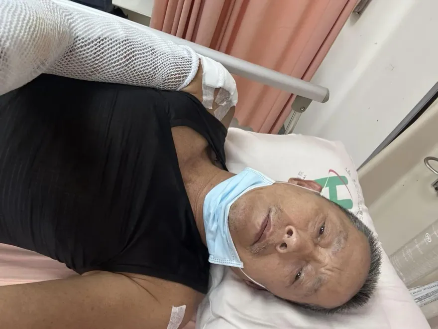 67歲資深演員路口緊急煞車釀車禍送醫　「右半身纏滿紗布」照片曝光