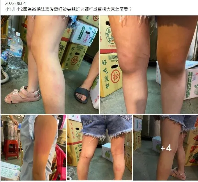 7歲女童「九九乘法」沒背好！被安親班爆打「四肢都是傷」　教育局介入調查