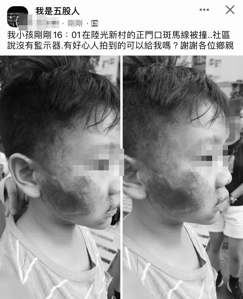 影/五股男童過馬路遭機車撞　臉「滿是血痕」父心疼臉書求援
