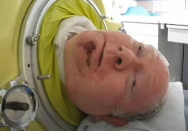 男子患小兒麻痺無法自主呼吸　躺6百磅鐵肺中生活70年