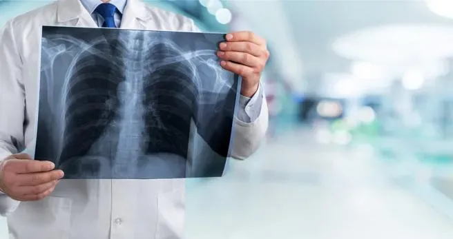 20多歲女罹肺腺癌！醫基因檢查發現：4大原因誘發