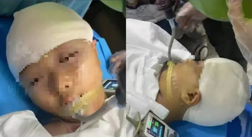 9歲女上課遭爆頭「插玻璃流腦漿」！男師竟先偷帶去縫合　開顱5小時命危