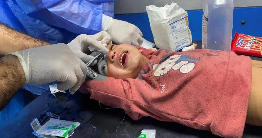 加薩麻藥短缺！女童縫額頭傷痛爆哭喊媽媽　有傷患咬紗布或背誦經文止痛