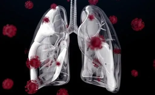 肺癌有症狀多已晚期！醫示警「7大症狀」咳不停要小心