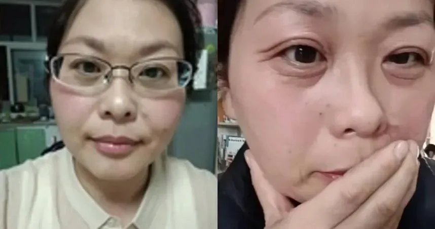 42歲女「斷崖式衰老」！20天臉上佈滿皺紋　8生活習慣是老化加速器