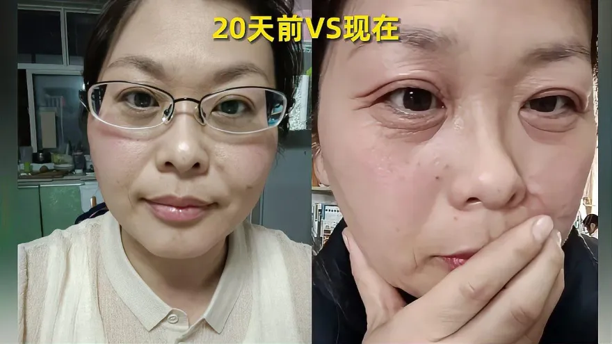影/20天變7旬嬤？42歲OL曬素顏照稱遇「斷崖式衰老」　專家：男性更早出現