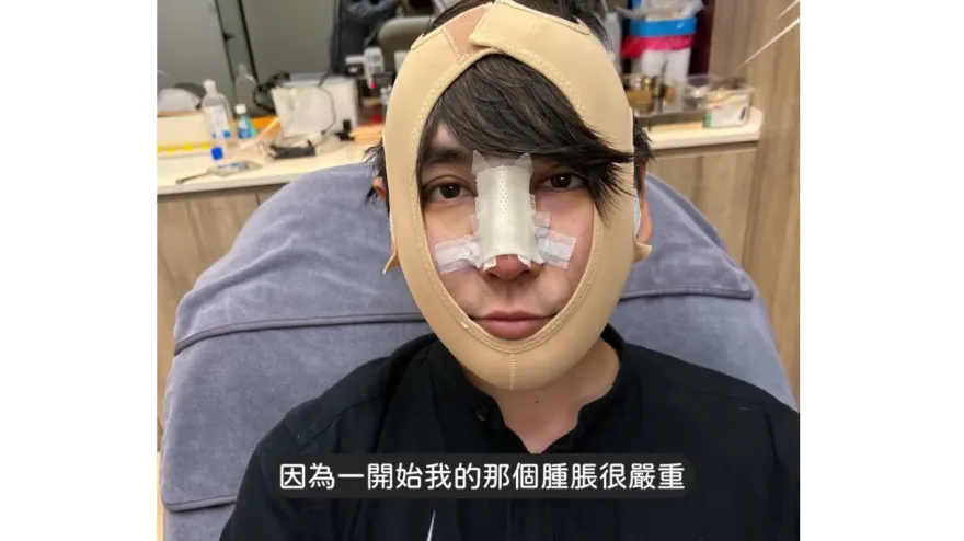 志祺七七變身韓系歐巴！公開整形部位　曝動刀後「雙親超崩潰」以為失敗