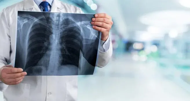 全球死亡率最高癌症！肺癌出現症狀多為晚期　國健署：肺癌篩檢早發現早治療
