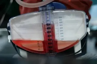 愛好「天然湧泉」喝地下水　檢查血尿慘罹膀胱癌！7大危險因子曝
