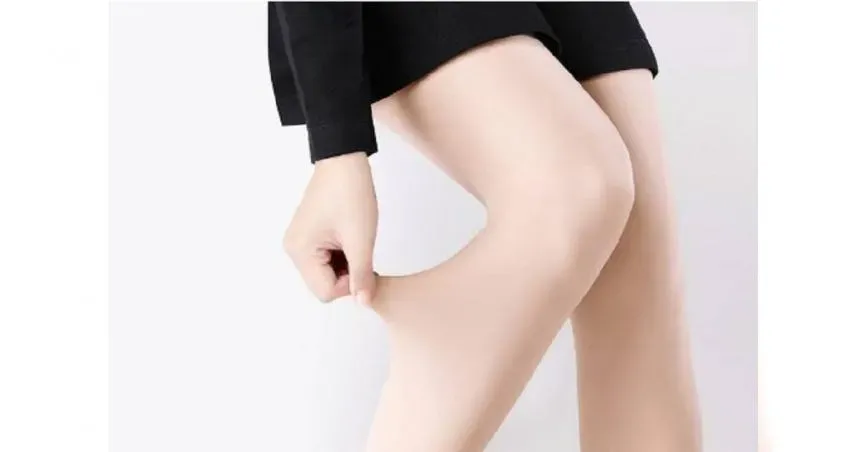 她穿「光腿神器」半個月雙腳水腫到不能走路　醫警「再穿就要手術！」