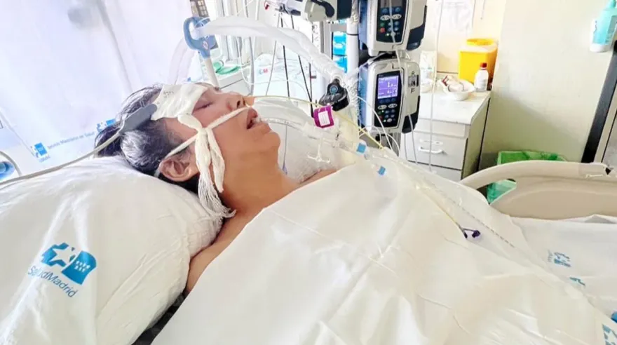 洪曉蕾插管續命！醫曝「脖子裡面都是膿」　還原病程：腫得像浮屍