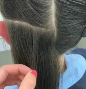 美髮師生涯最大挑戰？她幫女孩清頭皮　「一梳上百顆蟲卵」當場嚇傻