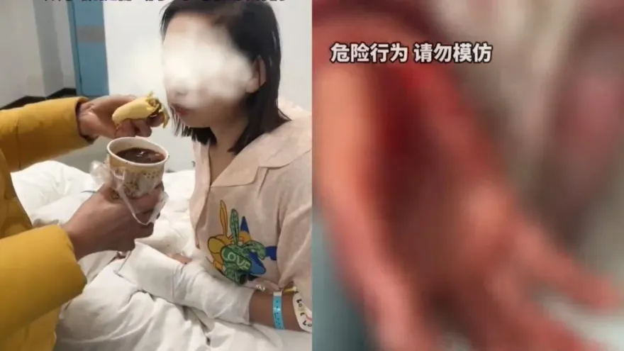 影/太狠了！只因延長線沒電…雙胞胎姊姊拿修眉刀割斷妹妹「雙手肌腱」