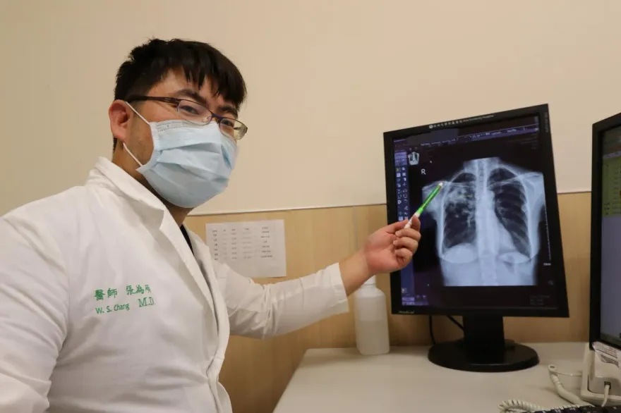 65歲婦化療後喘咳不止！就醫驚見「肺部竟開一個洞」　確診罕見隱球菌肺炎