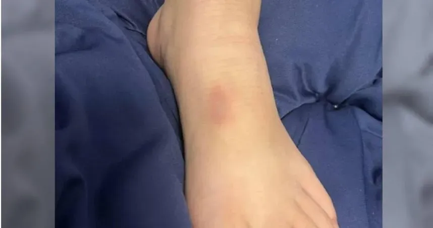 侮辱？孩子被超商鐵椅砸到瘀青　家長怒店家賠「紅包2000+禮盒」