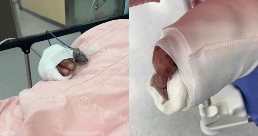 影/吃完宵夜莫名遭砍！新竹男慘被「斷指、腳筋露出」　妙齡女嚷：砍錯人了
