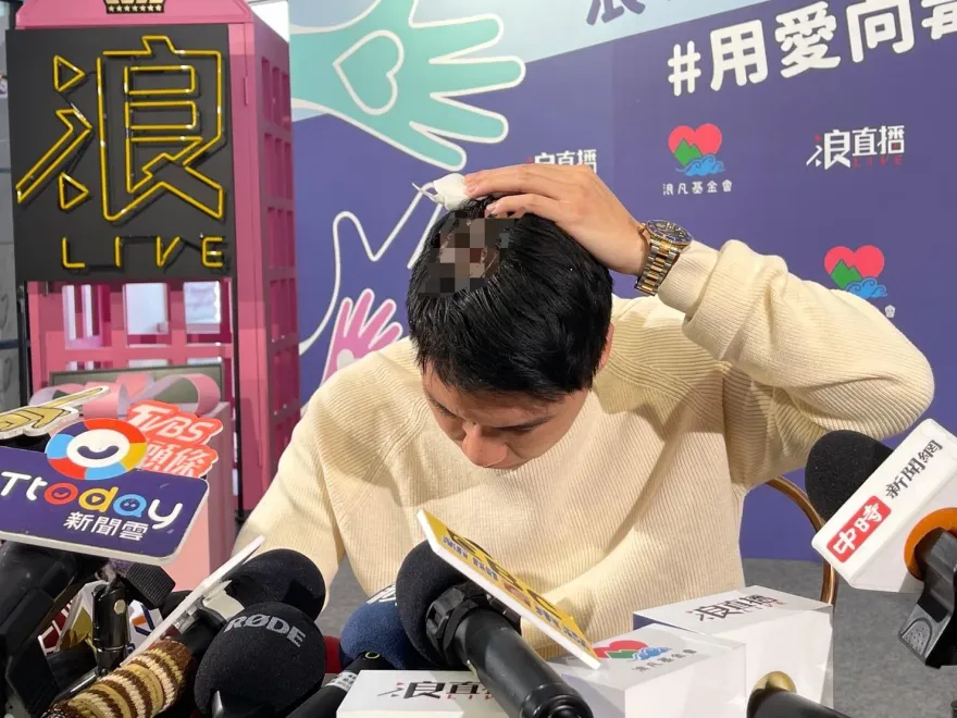Toyz現身記者會秀出頭上11針傷疤　喊話超哥做到兩點就和解