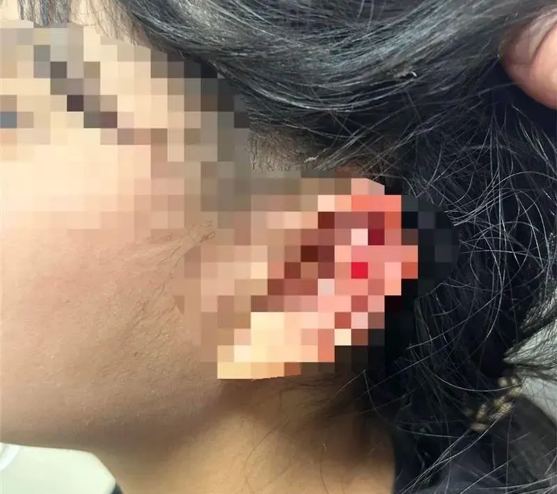 急尋目擊者！三峽少女遭橋下「向上射」沖天炮炸破耳膜　家屬發文緝「兇」