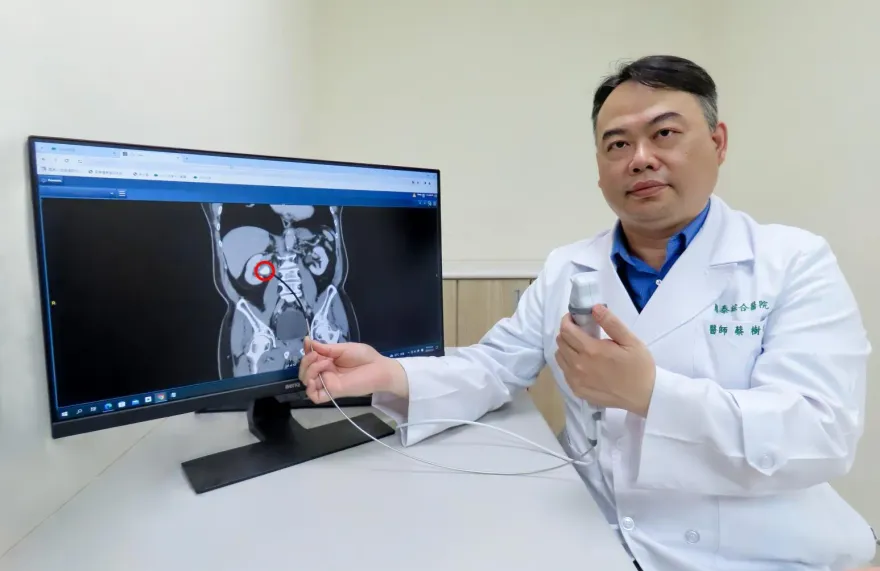 8旬翁持續半年無痛性血尿！醫一照驚見「2.5公分結石」卡死