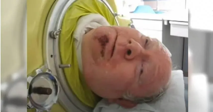 6歲患小兒麻痺「困鐵肺70年」還當上律師　美國傳奇男逝世享壽78歲