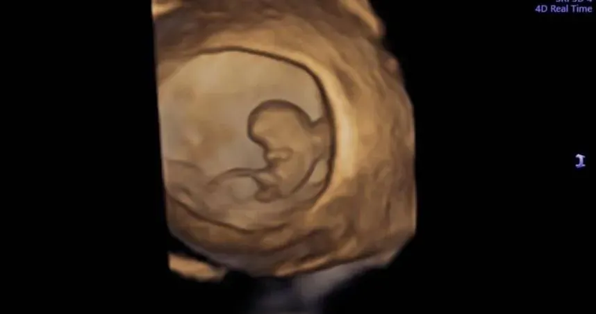 胎兒「身上1根」長到逆天！婦科名醫給答案：不是GG　全網笑翻
