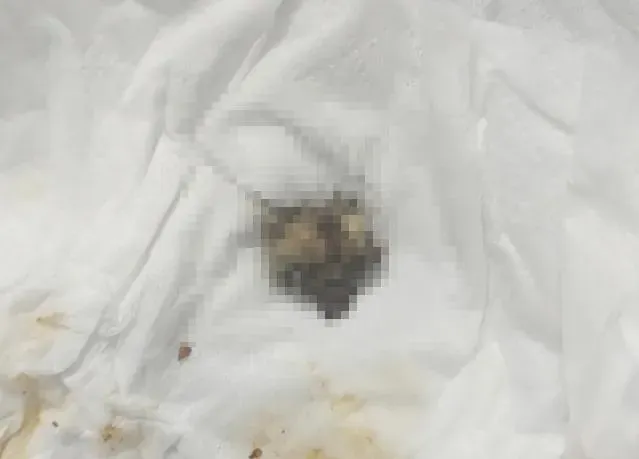 超噁！買豆瓣醬買到「米奇驚喜包」　整罐快吃完才發現「完整鼠頭」