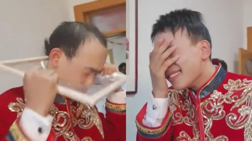 影/好「禿」然！新郎迎親挑戰「頭破保鮮膜」　下一秒「假髮掉了」笑翻全場