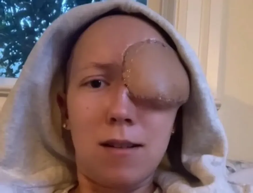美28歲女右眼痛被誤診鼻竇炎！二度就診驚見「高爾夫球大」腫塊　右眼慘被摘除