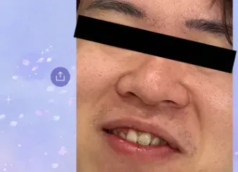 手殘傳男友露齒近照！LINE官方帳號無法收回　管理員義氣相挺不外流