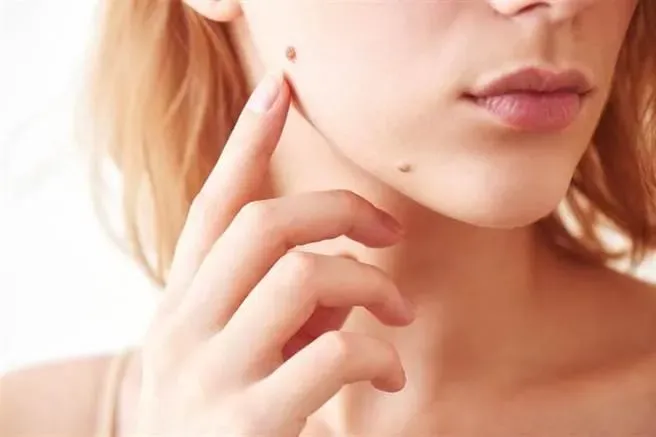 面相決定個人運勢！「3吉痣」長女人身上　注定一生不愁吃穿