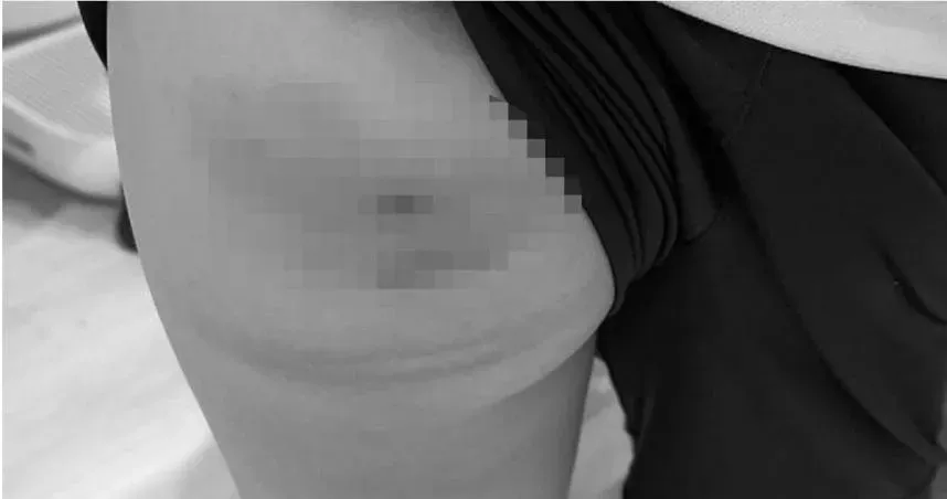 母見兒屁股一片瘀青氣炸喊告！北市國小教練爆「體罰9男童」這下慘了