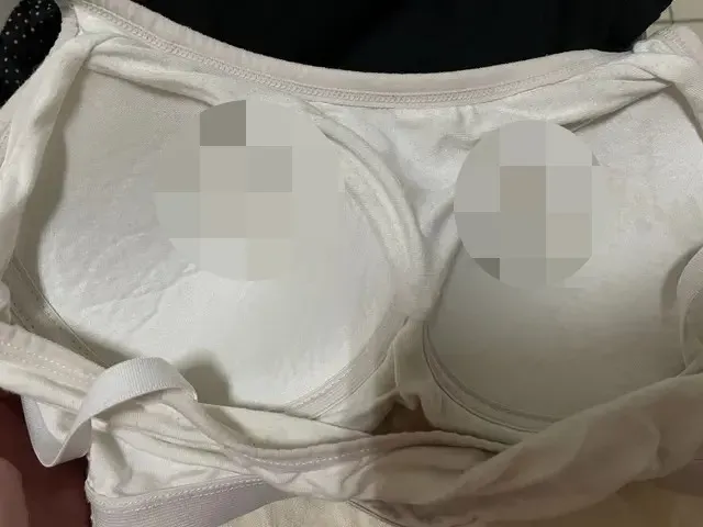 妹子內衣「兩點位置泛黃」！網友一看急勸就醫：可能是纖維囊腫