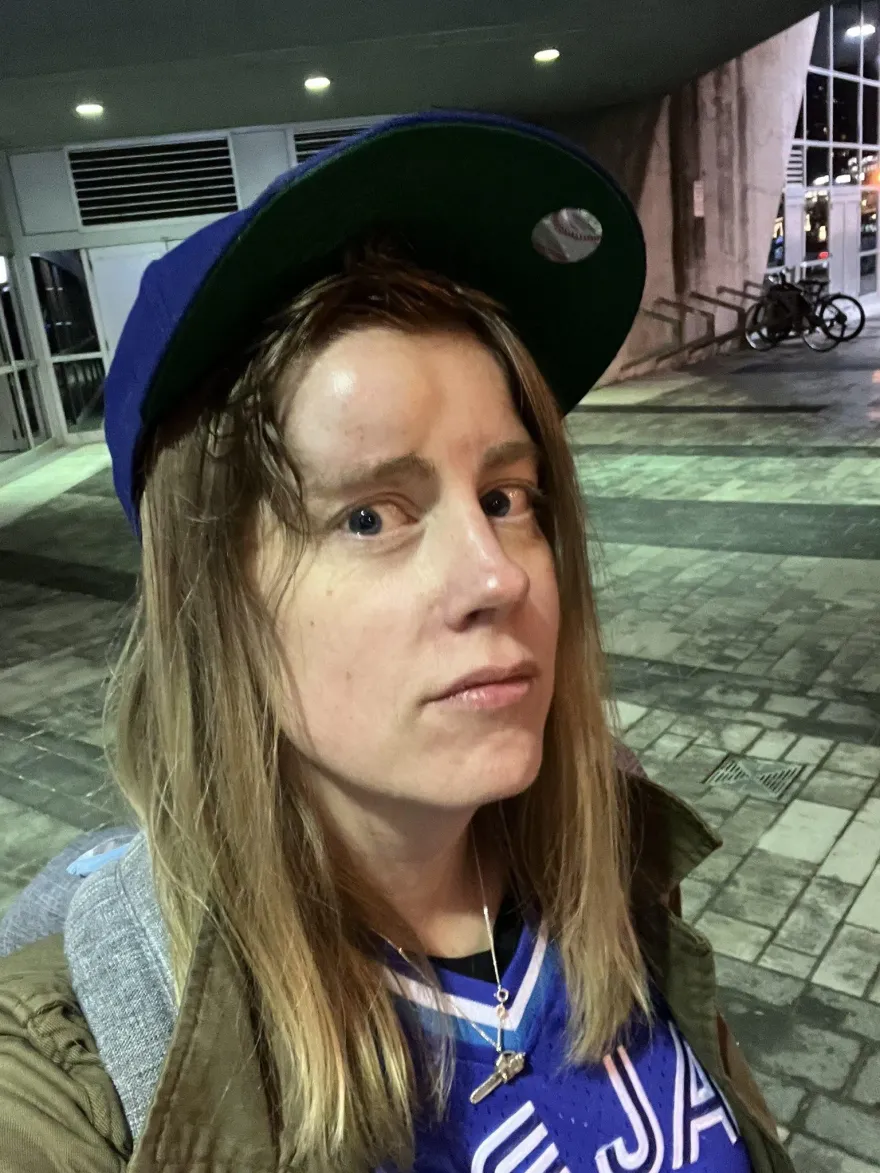 女硬漢！女球迷遭176公里界外球狠砸臉竟忍痛看完比賽　傷勢慘況曝