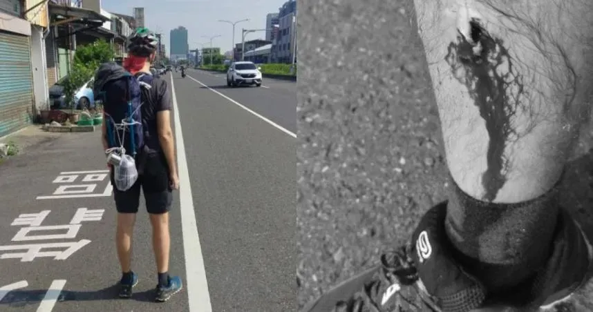 等公車「站牌前挨撞」小腿爆血　洋男行程被迫喊卡：是行人地獄首都