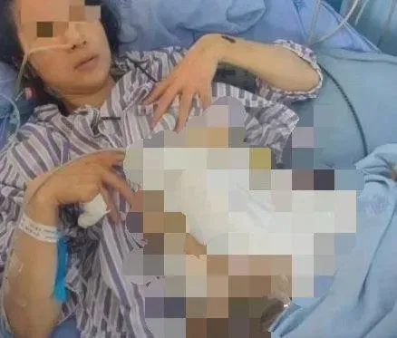 驚悚520婚姻！嫁過去2年遭家暴16次　被打暈醒來還被硬上「終身掛糞袋」