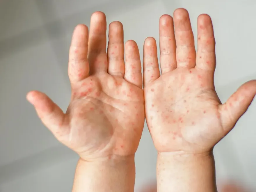 抗腸病毒新突破！研究：藍色微藻抽出蛋白 可抑制腸病毒！緩解新冠、流感！