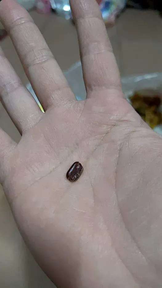 吃韭菜水餃「喀一下」！吐出來看竟是蟑螂蛋　網反胃：這嘴不能要了