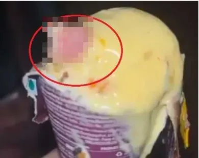 吃冰淇淋咬到硬塊！　印度醫一吐驚見「人類手指」：以為是堅果
