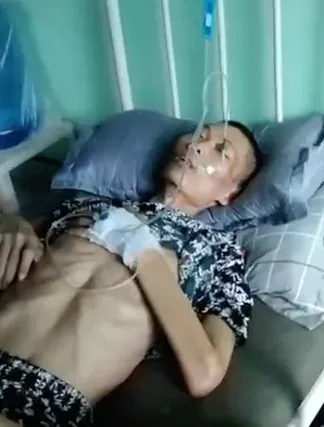 28歲男被朋友出賣慘淪「豬仔」！瘦成皮包骨、狂吐血　獲救返家仍離世