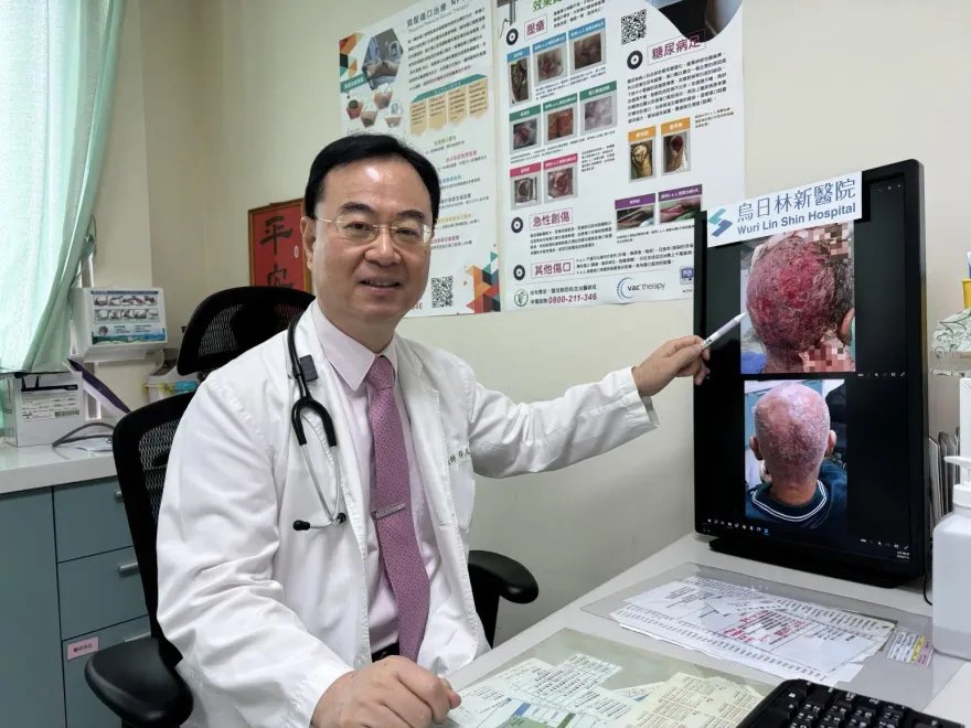 影/驚！69歲男服用標靶藥物「頭皮整片潰爛」　醫：最嚴重等級併發症