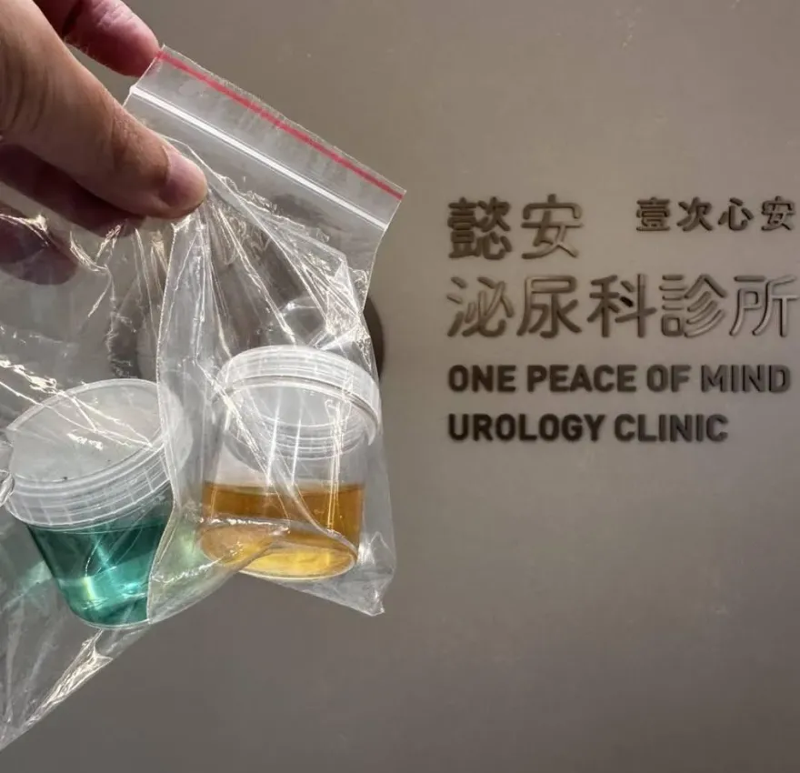 越南台商尿道炎「尿尿顏色變tiffany綠」！醫揭密和藥物有關
